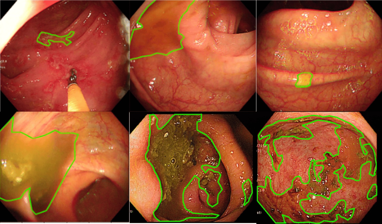 CT Scans