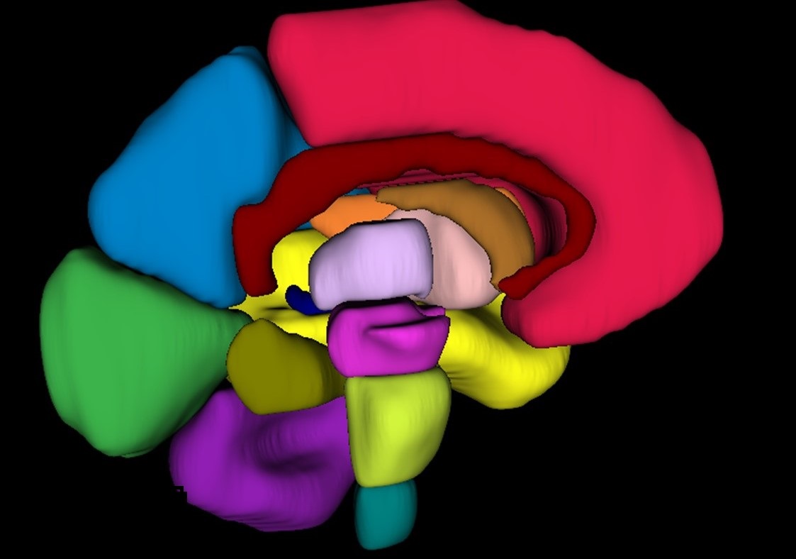 CT Scans