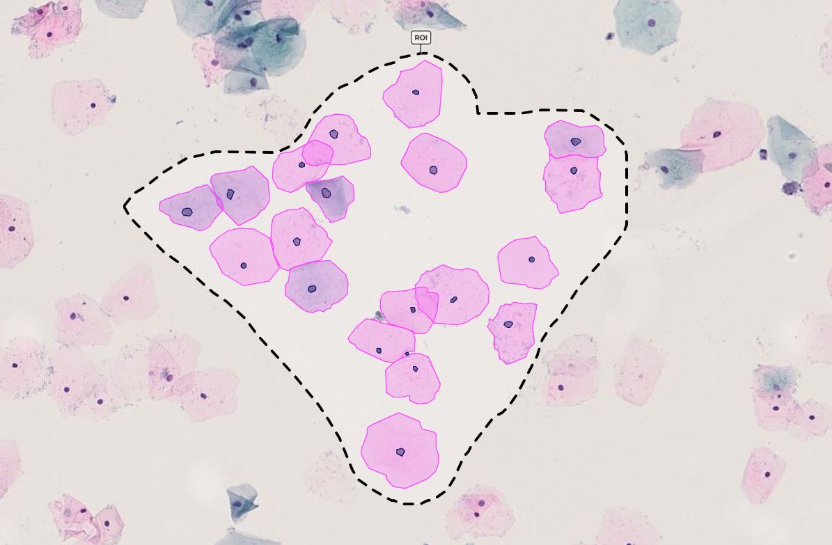 CT Scans